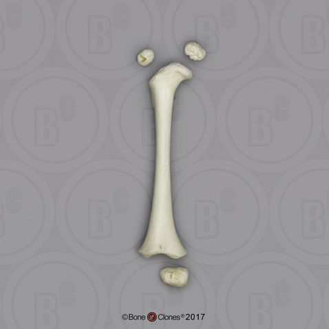 14 mo Child Femur