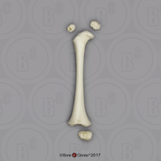 14 mo Child Femur