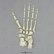 Disarticulated Foot