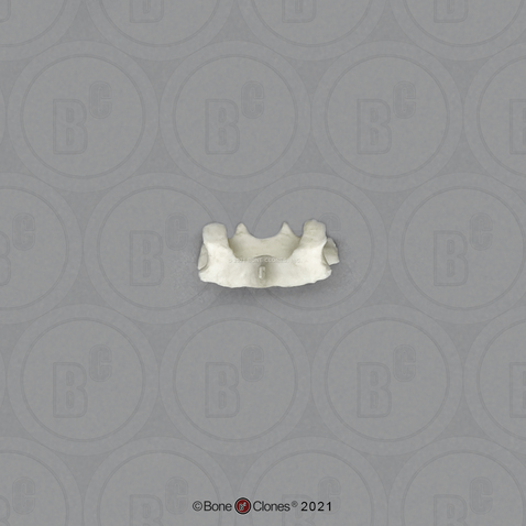 Vervet Cervical Vertebra, Single