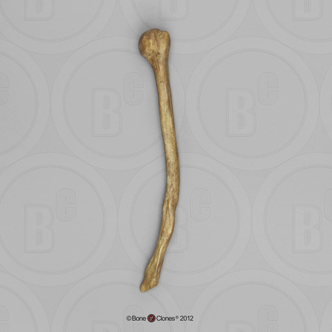 Homo neanderthalensis Shanidar 1 Humerus, atrophied,