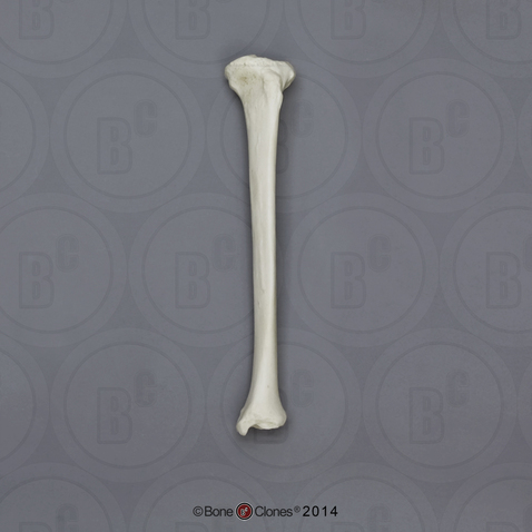 Human African-American Female Left Tibia