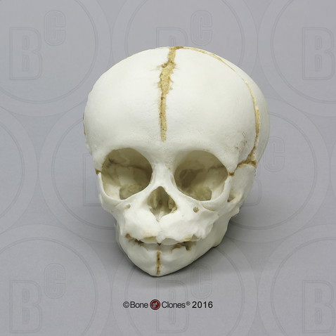 Chimpanzee Fetal Skull