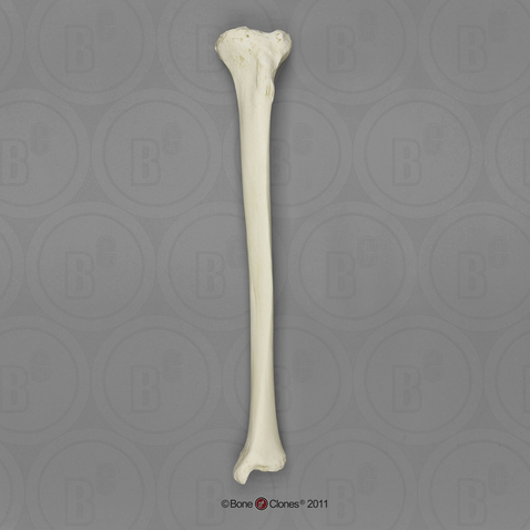 Human Male Asian Tibia