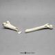 Human Native American Female Femur Fracture