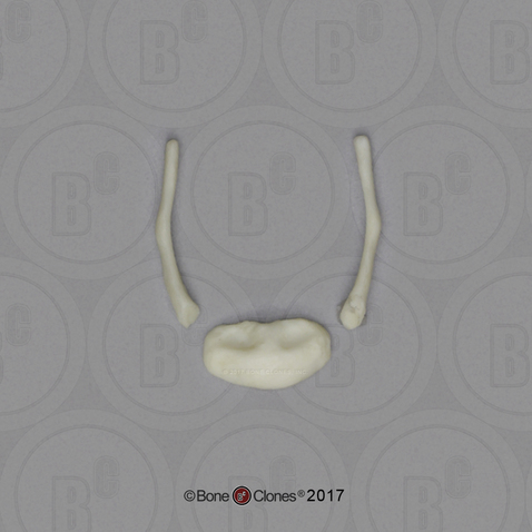 14 mo Child Hyoid