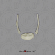 14 mo Child Hyoid