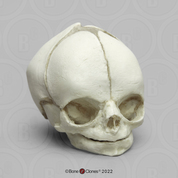 Fetal Human Skull 29 Weeks