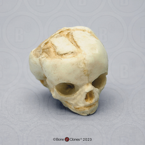 Fetal Human Skull 17 Weeks