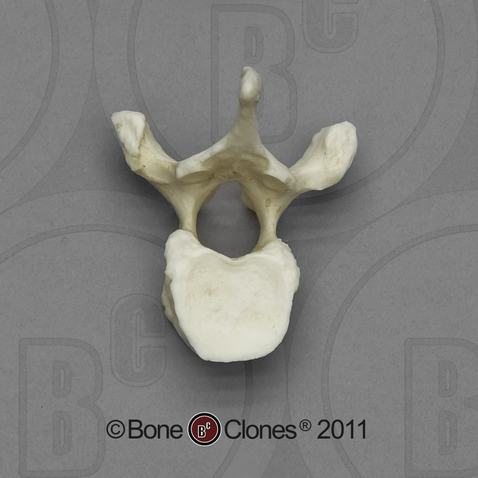 Human Female Asian Thoracic Vertebra, Single