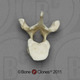 Human Female Asian Thoracic Vertebra, Single