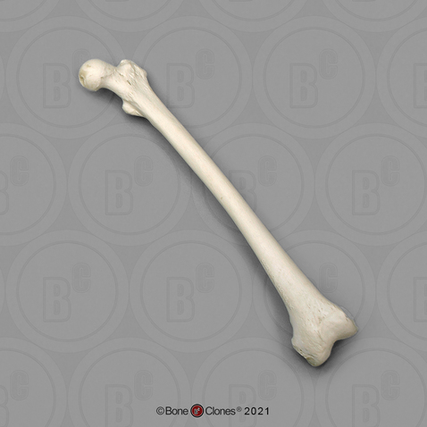 Human 39 Year Old Female Right Femur