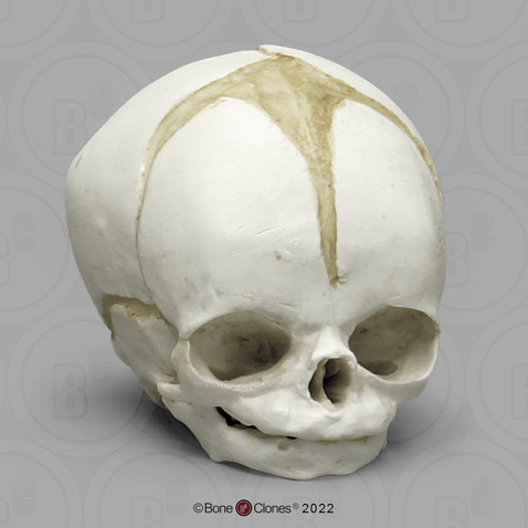 Fetal Human Skull 32 Weeks