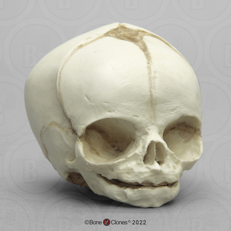 Fetal Human Skull 31 Weeks