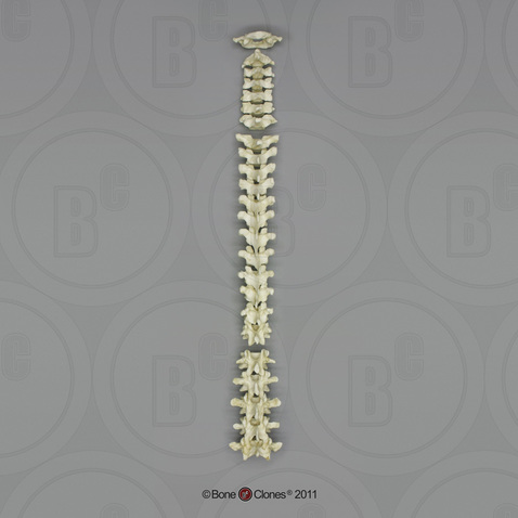 Human Male Asian Robust Vertebral Column-all 24 Vertebrae, Disarticulated