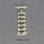 Human Male European Cervical Vertebrae, set of 7