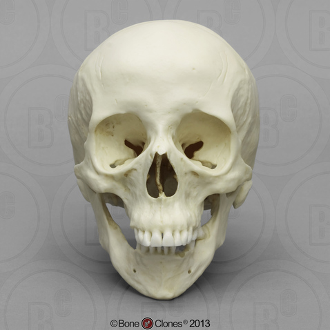 Human Hispanic Female Skull with Down syndrome