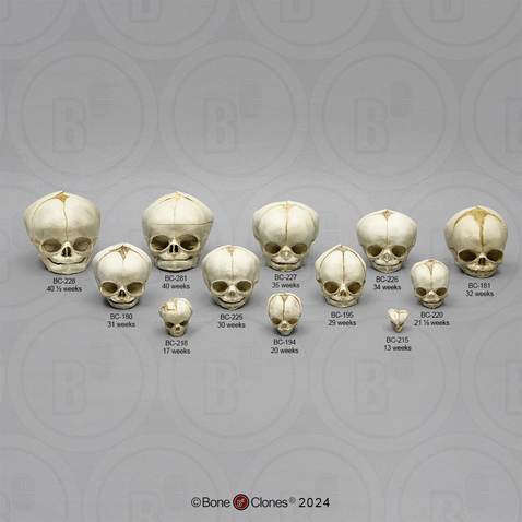 Human Fetal Skulls Set of 12