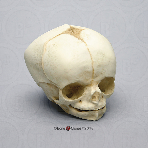 Fetal Human Skull 34 Weeks