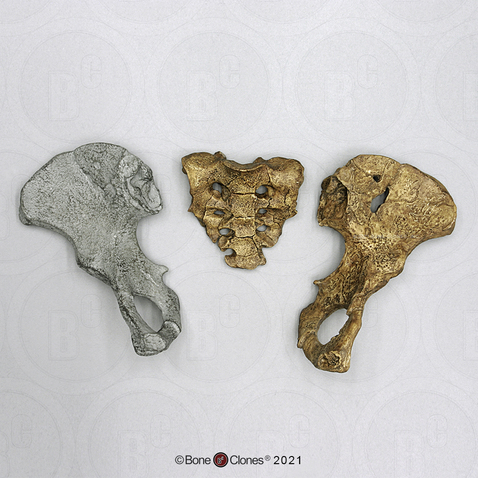 Australopithecus afarensis "Lucy" Pelvis, Disarticulated