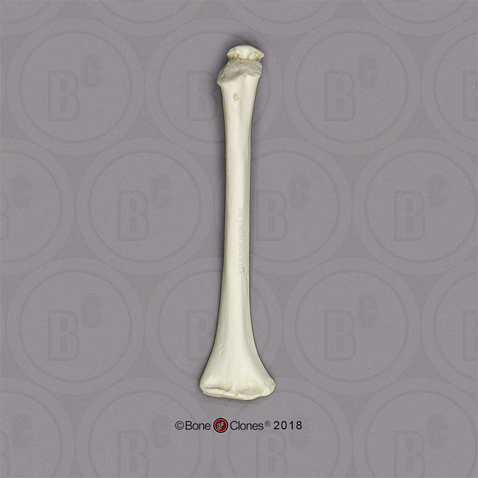 Humerus, 5-year-old Child