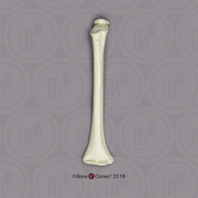 Humerus, 5-year-old Child