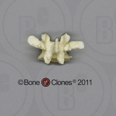 Human Female Asian Lumbar Vertebra, Single