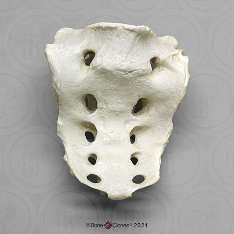 Human Sacrum and L-5 fused