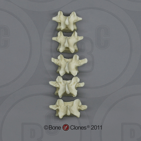 Human Adolescent Lumbar Vertebrae, Set of 5