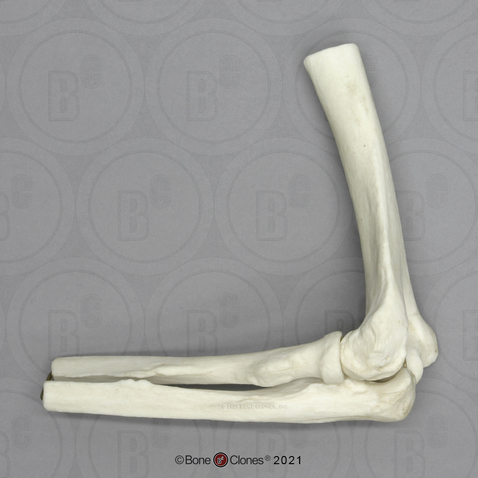 Human Elbow Joint