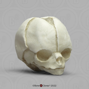 Fetal Human Skull 20 Weeks