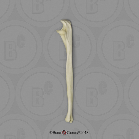 Human Male Asian Robust Ulna