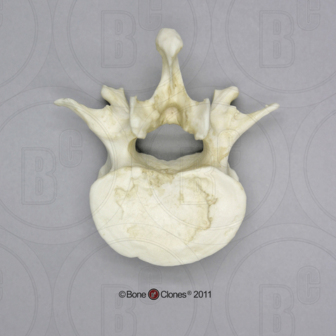 Human Male Asian Robust Lumbar Vertebra, Single