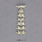 Rhesus Macaque Cervical Vertebrae, set of 7