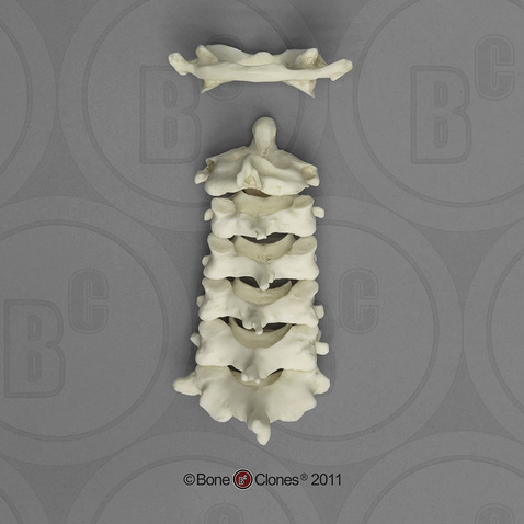 Human Male Asian Cervical Vertebrae, Set of 7