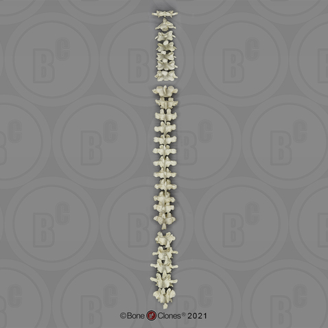 Gorilla Vertebral Column-all 24 Vertebrae, Disarticulated