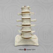 Lumbar Vertebra Display Set of 5 (Normal)