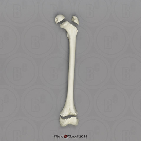 Human European American Male 13-year-old Femur and Epiphysis - 4pcs