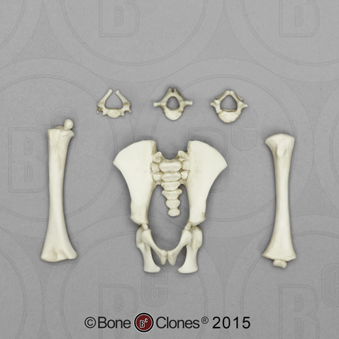 Fetal Chimpanzee C-2, T-4, L-4, Humerus, Femur, Pelvis, Sacrum and Coccyx