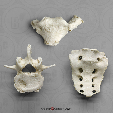 Human 65-year-old Male Manubrium, Sacrum, Vertebra Set