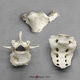 Human 65-year-old Male Manubrium, Sacrum, Vertebra Set