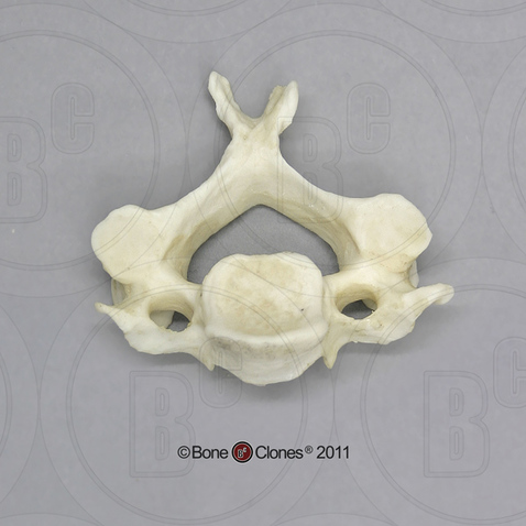 Human Male Asian Robust Cervical Vertebra, Single