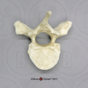 Human Male Asian Robust Thoracic Vertebra, Single