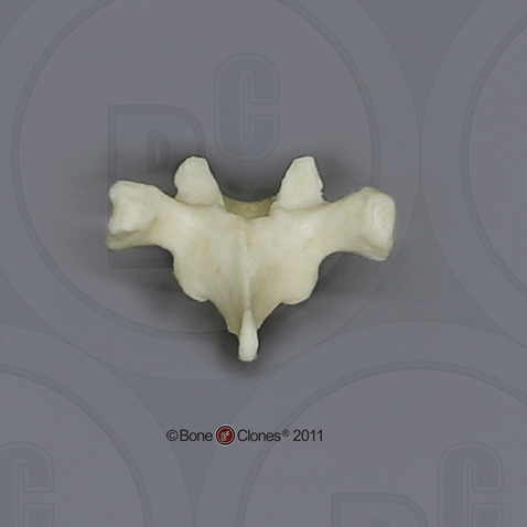 Human Adolescent Thoracic Vertebra, Single