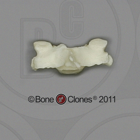 Human Female Asian Cervical Vertebra, Single