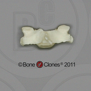 Human Female Asian Cervical Vertebra, Single