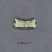 Human Adolescent Cervical Vertebra, Single