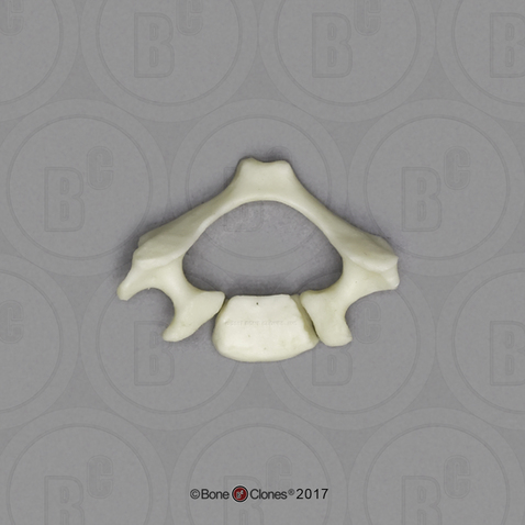 Human Child Cervical Vertebra Single (2 pcs.), 14 to 16-month-old