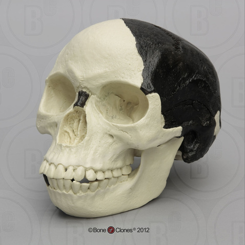 Piltdown Man Skull, 1912 Fraud