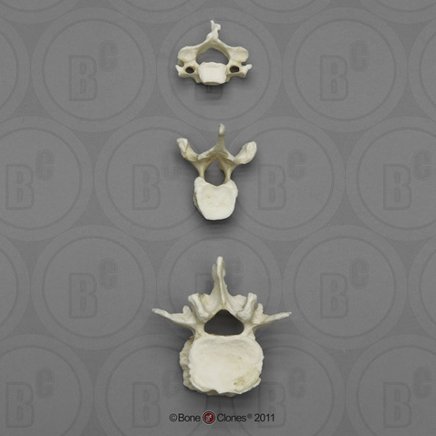 Human Female Asian Vertebrae, Set of 3 - Cervical, Thoracic, Lumbar